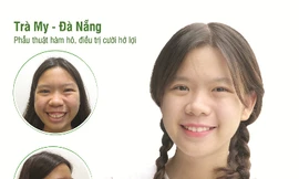 10 tỉ đồng phẫu thuật thẩm mỹ miễn phí cho người có hoàn cảnh khó khăn