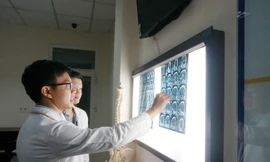 Chủ quan cụ bà suýt chết vì khối u khổng lồ trong não