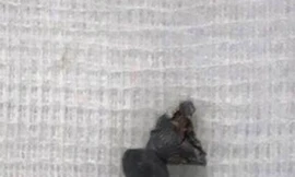 Đầu đạn súng hơi kẹt trong phế quản bé trai suốt 1 tháng