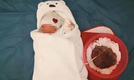 Xác minh thông tin tử vong do 'sinh con thuận tự nhiên'