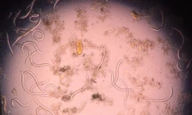 Coi chừng mất mạng vì nhiễm giun lươn