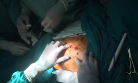 Chờ mổ chân, nam bệnh nhân tự dùng kéo... đâm thủng tim