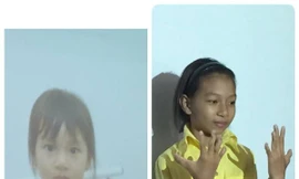 8 bệnh nhân dị tật bàn tay bẩm sinh sẽ được phẫu thuật miễn phí