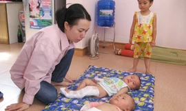 Đập lợn đất giúp đỡ cặp song sinh xương thủy tinh