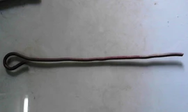 Đi chăn trâu, bé trai bị thanh thép đâm xuyên hậu môn