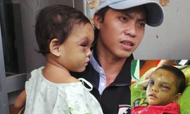 Anh Tố đến Bệnh viện Đa khoa Bình Dương sau khi nghe thông tin cháu Ngân bị bạo hành. Ảnh: Nguyên Hưng