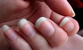 Móng tay có thể phát triển nhanh hơn so với móng chân tùy theo đặc điểm giới tính, chế độ ăn uống hay di truyền. (Ảnh minh họa: Flickr)