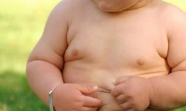 Béo phì dễ mắc 10 bệnh ung thư phổ biến