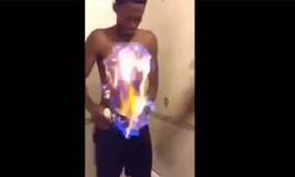 Thanh niên nghịch dại đốt lửa cháy khắp người