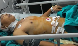 Bệnh nhân Nguyễn Hữu Thọ 