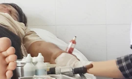 Không hút được thì “thầy” Đức dùng kim tiêm hút máu trực tiếp ra ống bơm. ảnh: H.D