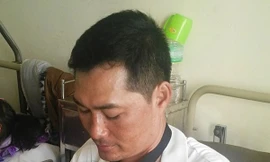 Đuổi cướp, thiếu úy công an bị chém