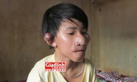 Cuộc sống cơ cực của cậu bé “Trư Bát Giới” bị cha bỏ rơi