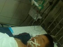 Ngã từ lan can, bé trai 6 tuổi vỡ lá lách