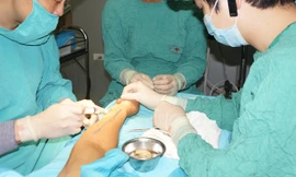 PGS-TS Vũ Quang Vinh (trái) đang phẫu thuật cho bệnh nhân bằng kỹ thuật vi phẫu. Ảnh: P.V