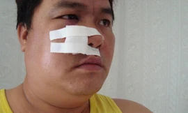 Những lần suýt chết trên phim trường của sao Việt