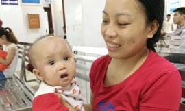  Bệnh nhi Khánh Vy bị viêm da cơ địa. Ảnh T.Hà