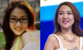 Chi 20.000 USD phẫu thuật mặt tròn thành... dài