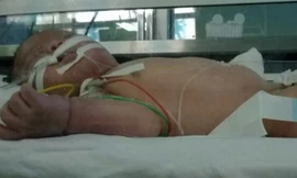 Bệnh nhi Khuất Tiến Minh đang điều trị tại Bệnh viện Nhi T.Ư. Ảnh: Infornet.