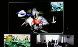 Bệnh viện Xanh Pôn thực hiện thành công 4 ca ghép thận