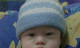 Bé Gammy đã bị bỏ lại với người mẹ người Thái Lan sau khi phát hiện bé mắc chứng Down. (Nguồn: dailytelegraph)
