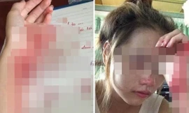 Hình ảnh bàn tay đầy máu và khuôn mặt thảm thương của P.K.M.