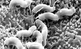 Vi khuẩn HP gây viêm dạ dày, thậm chí làm ung thư dạ dày