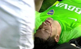 Thủ môn Orion bị hành hung ngay trong trận đấu.