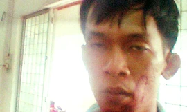 Bắt giam nguyên trung úy CSCĐ tấn công CSGT