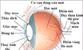 Bệnh viện Mắt Hà Nội: Lập lờ tráo nhân thủy tinh thể ?