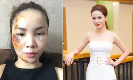 Tai nạn không may này đã khiến cô ca sĩ xinh đẹp phải hoảng sợ và lo lắng, bên cạnh việc phải huỷ hết lịch làm việc của mình, điều Yến Trang âu lo nhất là việc để lại sẹo trên gương mặt của mình. 