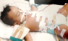 Bé Phụng đang được cấp cứu tại bệnh viện