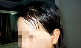 Xung quanh vụ bác sĩ bạo hành vợ ép ly hôn