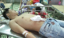 Đi chơi tết, bị đâm trọng thương
