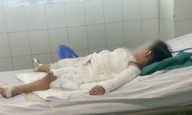 Uống nhầm nước tẩy bồn cầu, bé 2 tuổi bỏng nặng, bố bế cũng bị bỏng theo