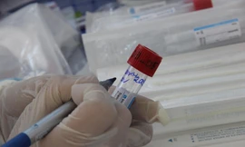 Đà Nẵng sẽ thanh tra việc mua sắm sinh phẩm, kit xét nghiệm