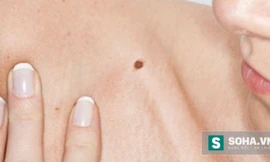 Ảnh minh hoạ: Internet