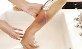 Ảnh minh hoạ: Internet