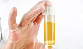 Ảnh minh hoạ: Internet