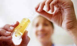 Ảnh minh hoạ: Internet