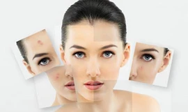 Ảnh minh họa: Internet