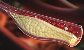 Ảnh minh họa: Internet