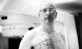 Các bác sĩ đánh dấu lên ngực Bogler để tiến hành hóa trị. Ảnh: David Jay.