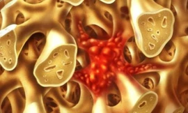 Ảnh minh hoạ: Internet