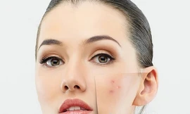 Ảnh minh hoạ: Internet