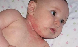 Ảnh minh họa: Internet