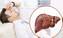 Ảnh minh hoạ: Internet