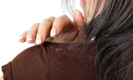 Ảnh minh hoạ: Internet