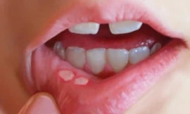 Ảnh minh hoạ: Internet