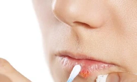 Ảnh minh hoạ: Internet